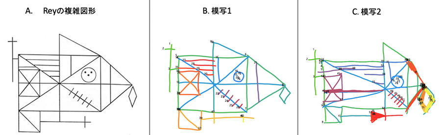 認知機能トレーニングプログラム Ctp ライデック